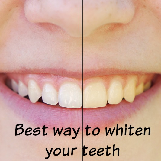 The best way to whiten teeth #whiten teeth  https://www.style-yourself-confident.com/best-way-to-whiten-teeth.html