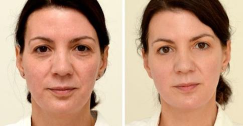 How to look 10 years younger - 5 darn good reasons to drink more water #drink more water  https://www.style-yourself-confident.com/reasons-to-drink-more-water.html