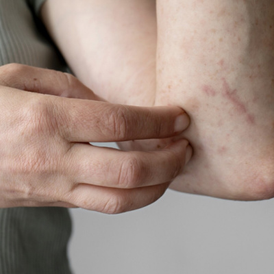 Stress and skin health 1 Stress and skin health 1